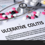 colitis